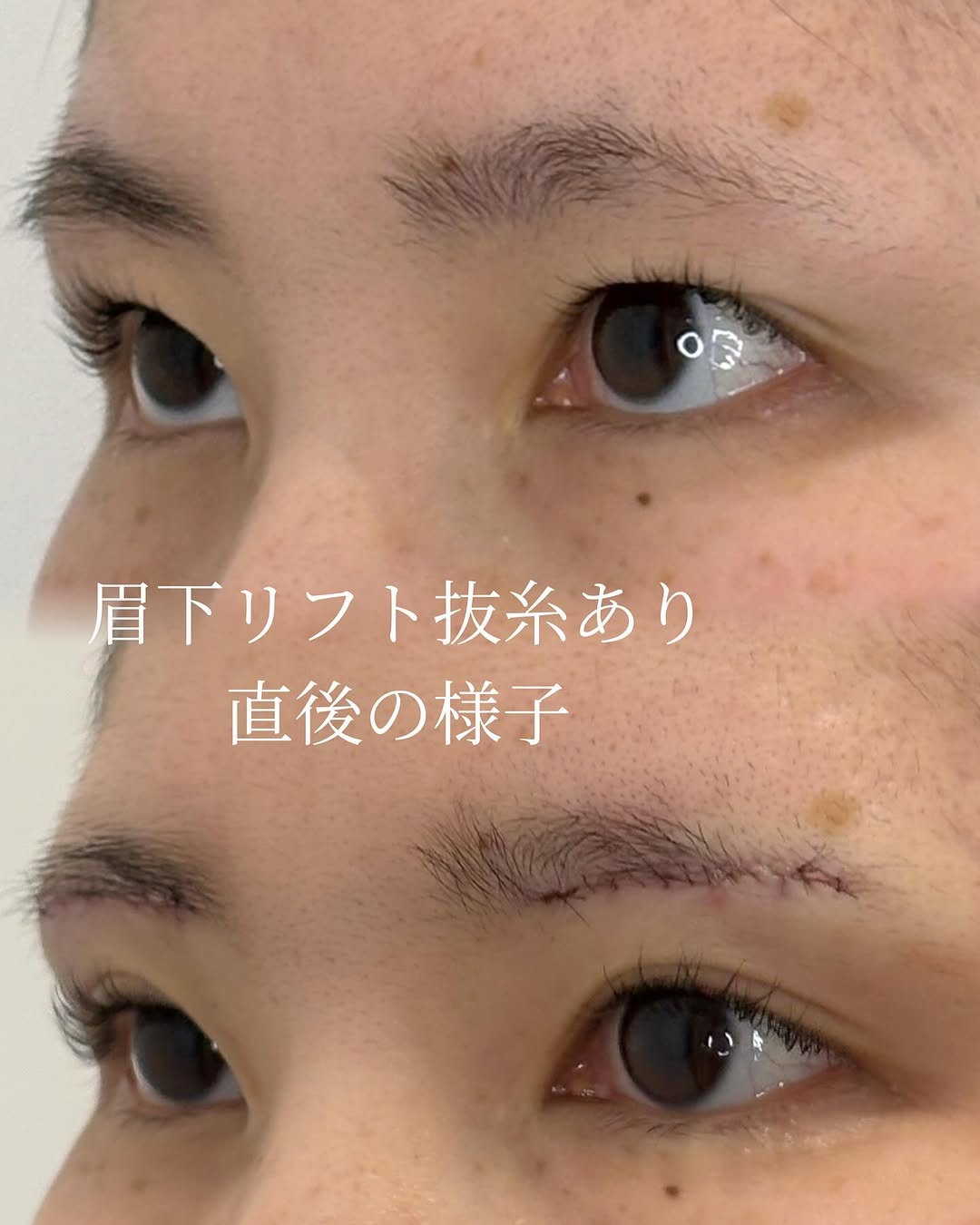 症例