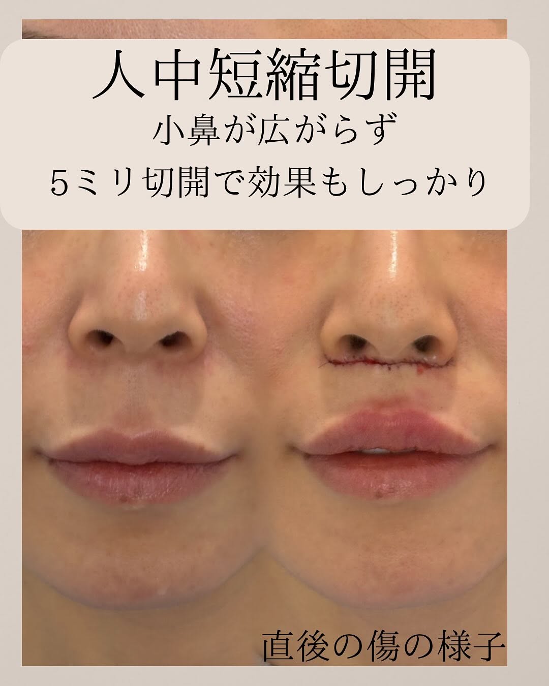 症例
