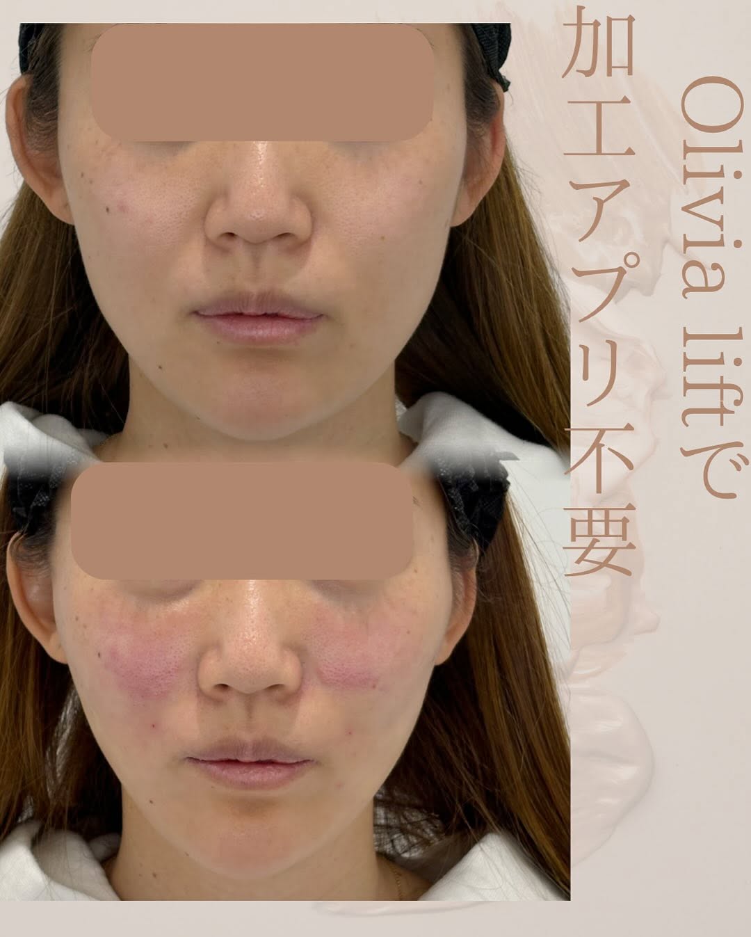 症例