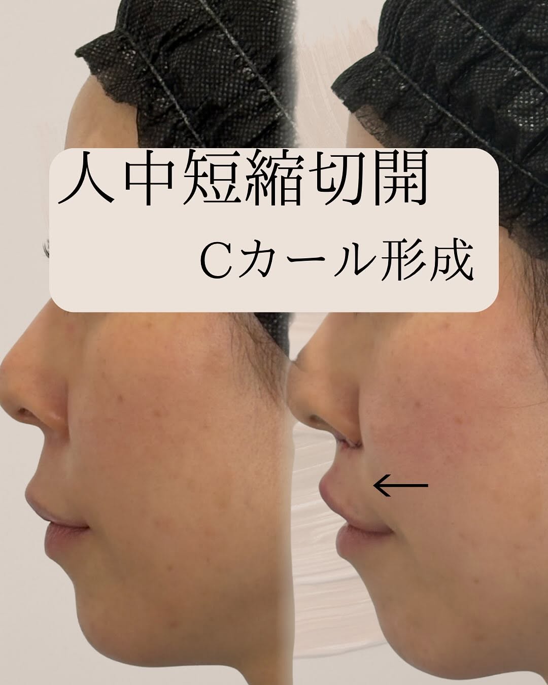 症例