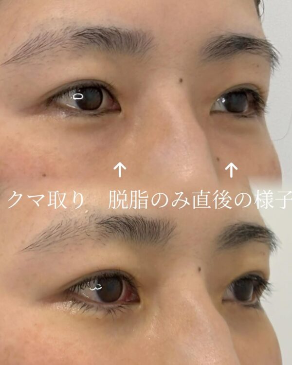 症例