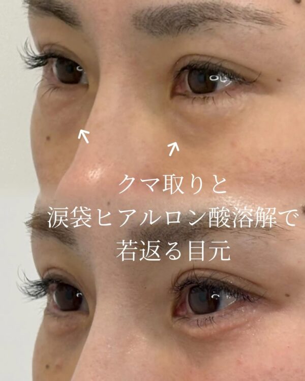症例