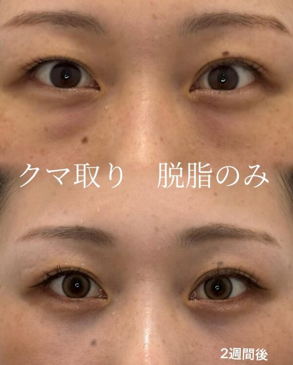 症例