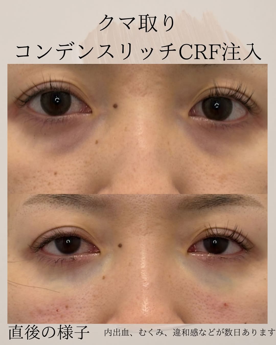 症例