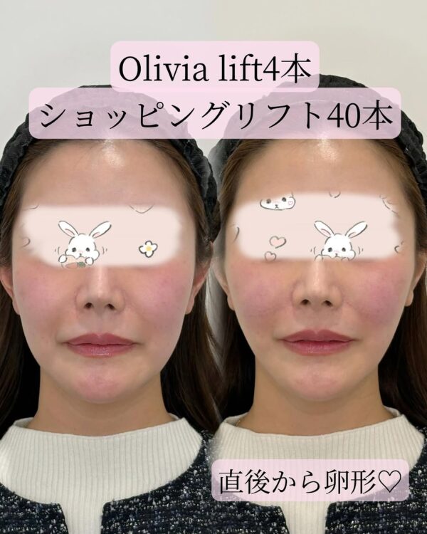 13 Olivia lift × ショッピングリフト