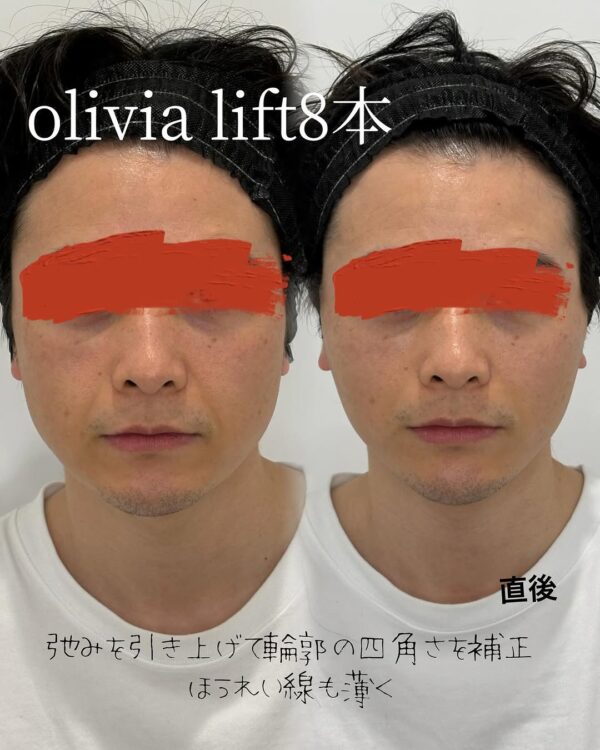 28 Olivia lift