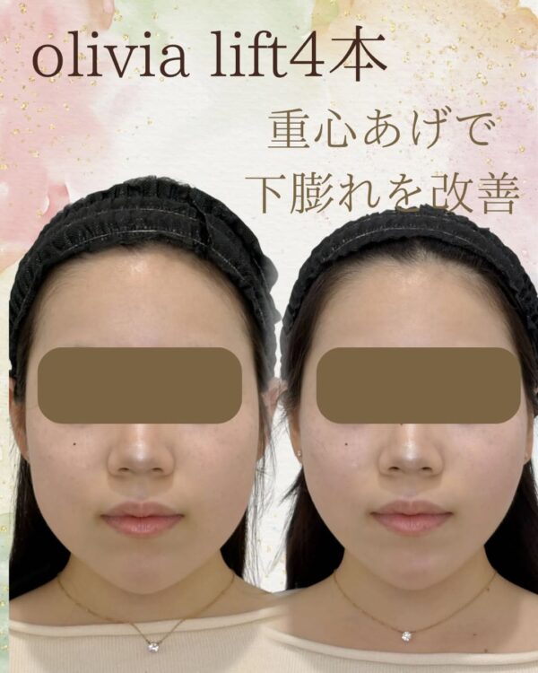 78 Olivia lift
