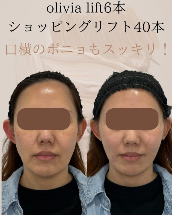 121 Olivia lift × ショッピングリフト
