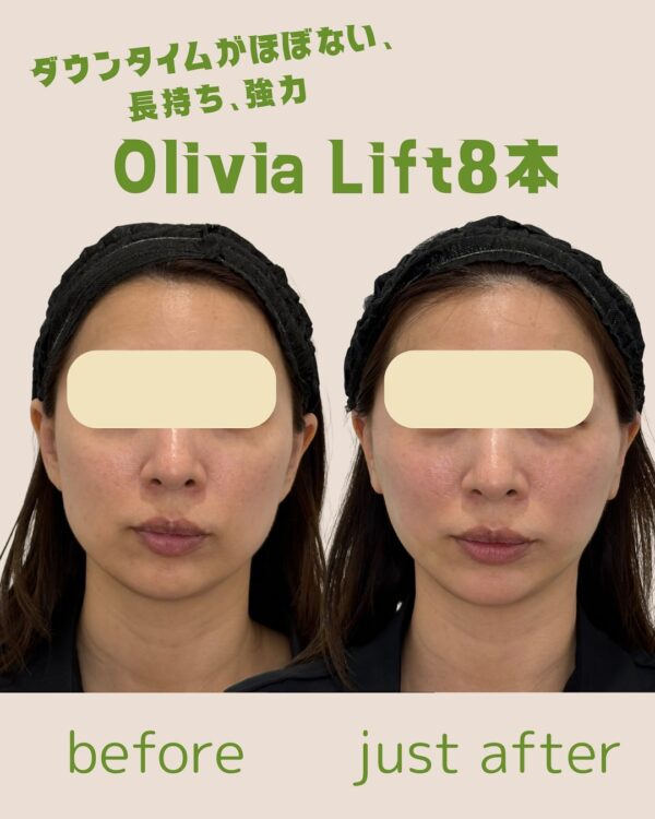 145 Olivia lift × ショッピングリフト
