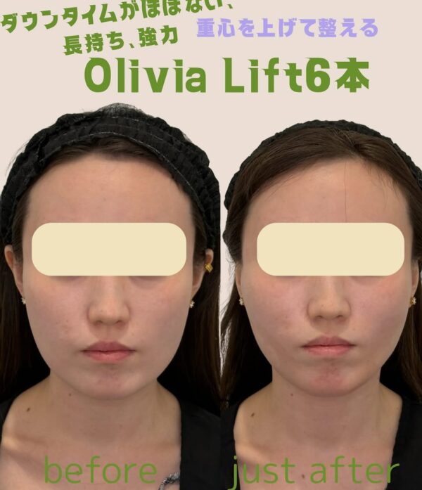 168 Olivia lift