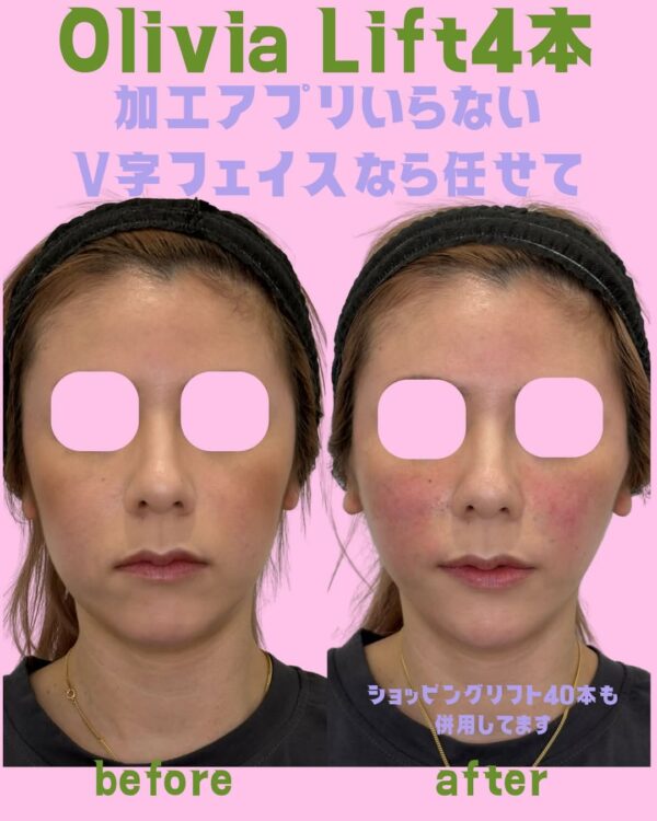 326 Olivia lift × ショッピングリフト